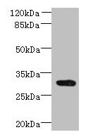 CCDC127 Antibody - Western blot All lanes: CCDC127 antibody at 6µg/ml + Mouse kidney tissue Secondary Goat polyclonal to rabbit IgG at 1/10000 dilution Predicted band size: 31 kDa Observed band size: 31 kDa