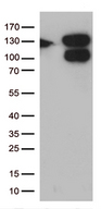 CCDC132 Antibody - HEK293T cells were transfected with the pCMV6-ENTRY control. (Left lane) or pCMV6-ENTRY CCDC132. (Right lane) cDNA for 48 hrs and lysed. Equivalent amounts of cell lysates. (5 ug per lane) were separated by SDS-PAGE and immunoblotted with anti-CCDC132. (1:500)