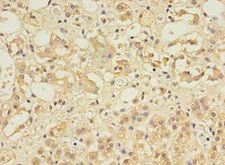 CCDC134 Antibody - Immunohistochemistry of paraffin-embedded human adrenal gland using antibody at 1:100 dilution.  This image was taken for the unconjugated form of this product. Other forms have not been tested.