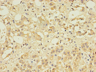 CCDC134 Antibody - Immunohistochemistry of paraffin-embedded human adrenal gland tissue using CCDC134 Antibody at dilution of 1:100