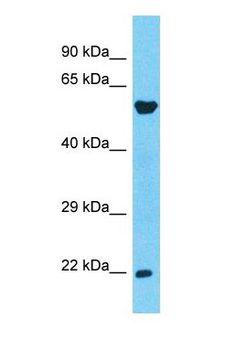 CCDC134 Antibody - Western blot of CCDC134 Antibody with human Fetal Liver lysate.  This image was taken for the unconjugated form of this product. Other forms have not been tested.