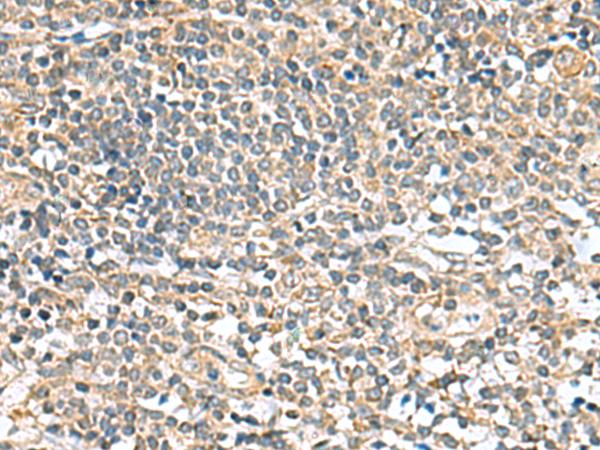 CCDC134 Antibody - Immunohistochemistry of paraffin-embedded Human tonsil tissue  using CCDC134 Polyclonal Antibody at dilution of 1:50(×200)