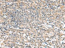CCDC134 Antibody - Immunohistochemistry of paraffin-embedded Human tonsil tissue  using CCDC134 Polyclonal Antibody at dilution of 1:50(×200)