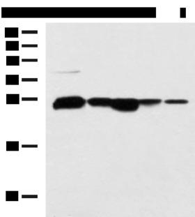 CCDC134 Antibody - Western blot analysis of 293T HepG2 cell Human fetal liver tissue Human liver tissue TM4 cell lysates  using CCDC134 Polyclonal Antibody at dilution of 1:800