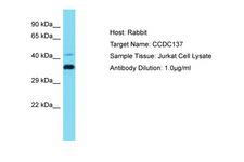 CCDC137 Antibody -  This image was taken for the unconjugated form of this product. Other forms have not been tested.