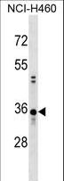 CCDC137 Antibody - CCDC137 Antibody western blot of NCI-H460 cell line lysates (35 ug/lane). The CCDC137 antibody detected the CCDC137 protein (arrow).
