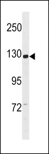CCDC14 Antibody - CCD14 Antibody western blot of SK-BR-3 cell line lysates (35 ug/lane). The CCD14 antibody detected the CCD14 protein (arrow).