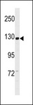 CCDC14 Antibody - CCD14 Antibody western blot of SK-BR-3 cell line lysates (35 ug/lane). The CCD14 antibody detected the CCD14 protein (arrow).