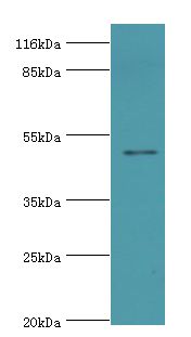 CCDC14 Antibody - Western blot. All lanes: CCDC14 antibody at 2 ug/ml+Jurkat whole cell lysate. Secondary antibody: Goat polyclonal to rabbit at 1:10000 dilution. Predicted band size: 51 kDa. Observed band size: 51 kDa.  This image was taken for the unconjugated form of this product. Other forms have not been tested.