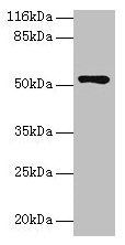 CCDC14 Antibody - Western blot All lanes: CCDC14 antibody at 2µg/ml + Jurkat whole cell lysate Secondary Goat polyclonal to rabbit IgG at 1/10000 dilution Predicted band size: 107, 84, 89, 52, 102 kDa Observed band size: 52 kDa