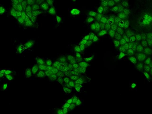 CCDC141 Antibody - Immunofluorescence staining of CCDC141 in A431 cells. Cells were fixed with 4% PFA, permeabilzed with 0.1% Triton X-100 in PBS, blocked with 10% serum, and incubated with rabbit anti-Human CCDC141 polyclonal antibody (dilution ratio 1:200) at 4°C overnight. Then cells were stained with the Alexa Fluor 488-conjugated Goat Anti-rabbit IgG secondary antibody (green). Positive staining was localized to Nucleus and Cytoplasm.