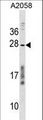 CCDC144NL Antibody - CCDC144NL Antibody western blot of A2058 cell line lysates (35 ug/lane). The CCDC144NL antibody detected the CCDC144NL protein (arrow).
