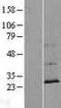 CCDC144NL Protein - Western validation with an anti-DDK antibody * L: Control HEK293 lysate R: Over-expression lysate