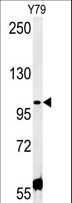 CCDC146 Antibody - CCDC146 Antibody western blot of Y79 cell line lysates (35 ug/lane). The CCDC146 antibody detected the CCDC146 protein (arrow).