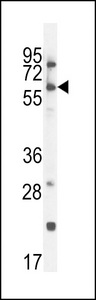 CCDC148 Antibody - CCDC148 Antibody western blot of A2058 cell line lysates (35 ug/lane). The CCDC148 antibody detected the CCDC148 protein (arrow).