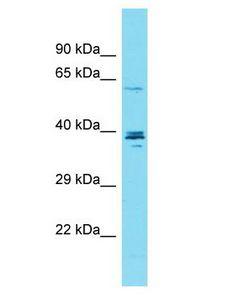 CCDC149 Antibody - CCDC149 antibody Western Blot of OVCAR-3. Antibody dilution: 1 ug/ml.  This image was taken for the unconjugated form of this product. Other forms have not been tested.
