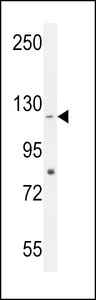 CCDC15 Antibody - CCDC15 Antibody western blot of HepG2 cell line lysates (35 ug/lane). The CCDC15 antibody detected the CCDC15 protein (arrow).