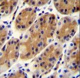CCDC153 Antibody - CCDC153 Antibody immunohistochemistry of formalin-fixed and paraffin-embedded human stomach tissue followed by peroxidase-conjugated secondary antibody and DAB staining.