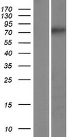 CCDC154 Protein - Western validation with an anti-DDK antibody * L: Control HEK293 lysate R: Over-expression lysate