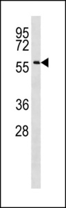 CCDC155 Antibody - CCDC155 Antibody western blot of NCI-H460 cell line lysates (35 ug/lane). The CCDC155 antibody detected the CCDC155 protein (arrow).