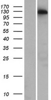 CCDC158 Protein - Western validation with an anti-DDK antibody * L: Control HEK293 lysate R: Over-expression lysate