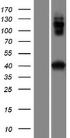 CCDC159 Protein - Western validation with an anti-DDK antibody * L: Control HEK293 lysate R: Over-expression lysate