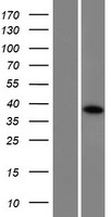 CCDC160 Protein - Western validation with an anti-DDK antibody * L: Control HEK293 lysate R: Over-expression lysate