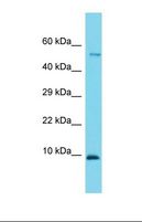 CCDC167 / C6orf129 Antibody - Western blot of Mouse Small Intestine. 1110021J02Rik antibody dilution 1.0 ug/ml.  This image was taken for the unconjugated form of this product. Other forms have not been tested.