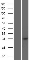 CCDC169 Protein - Western validation with an anti-DDK antibody * L: Control HEK293 lysate R: Over-expression lysate