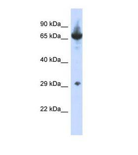 CCDC17 Antibody - Western blot of Human HepG2. CCDC17 antibody dilution 1.0 ug/ml.  This image was taken for the unconjugated form of this product. Other forms have not been tested.