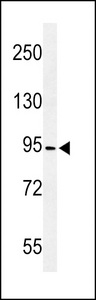 CCDC170 / C6orf97 Antibody - Western blot of CF097 Antibody in MDA-MB435 cell line lysates (35 ug/lane). CF097 (arrow) was detected using the purified antibody.