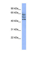 CCDC174 Antibody - C3orf19 antibody Western blot of HepG2 cell lysate. This image was taken for the unconjugated form of this product. Other forms have not been tested.