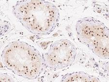 CCDC178 / C18orf34 Antibody - Immunochemical staining of human C18orf34 in human testis with rabbit polyclonal antibody at 1:1000 dilution, formalin-fixed paraffin embedded sections.