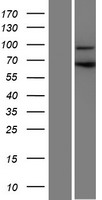 CCDC178 / C18orf34 Protein - Western validation with an anti-DDK antibody * L: Control HEK293 lysate R: Over-expression lysate