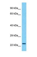 CCDC183 / KIAA1984 Antibody - Western blot of CCDC183 Antibody with human Placenta lysate.  This image was taken for the unconjugated form of this product. Other forms have not been tested.