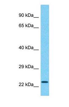 CCDC183 / KIAA1984 Antibody - Western blot of CCDC183 Antibody with human Placenta lysate.  This image was taken for the unconjugated form of this product. Other forms have not been tested.
