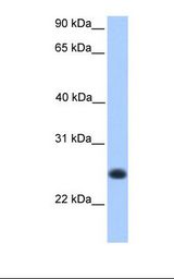 CCDC184 Antibody - Fetal muscle lysate. Antibody concentration: 1.0 ug/ml. Gel concentration: 12%.  This image was taken for the unconjugated form of this product. Other forms have not been tested.