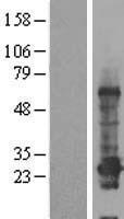 CCDC184 Protein - Western validation with an anti-DDK antibody * L: Control HEK293 lysate R: Over-expression lysate