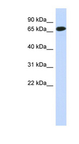 CCDC185 Antibody - C1orf65 antibody Western blot of Fetal Muscle lysate. This image was taken for the unconjugated form of this product. Other forms have not been tested.