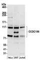 CCDC186 / C10orf118 Antibody - Detection of human CCDC186 by western blot. Samples: Whole cell lysate (15 µg) from HeLa, HEK293T, and Jurkat cells prepared using NETN lysis buffer. Antibody: Affinity purified rabbit anti-CCDC186 antibody used for WB at 1:1000. Detection: Chemiluminescence with an exposure time of 3 minutes.