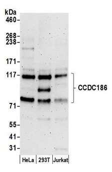 CCDC186 / C10orf118 Antibody - Detection of human CCDC186 by western blot. Samples: Whole cell lysate (15 µg) from HeLa, HEK293T, and Jurkat cells prepared using NETN lysis buffer. Antibody: Affinity purified rabbit anti-CCDC186 antibody used for WB at 1:1000. Detection: Chemiluminescence with an exposure time of 3 minutes.