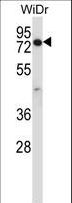 CCDC22 Antibody - CCDC22 Antibody western blot of WiDr cell line lysates (35 ug/lane). The CCDC22 antibody detected the CCDC22 protein (arrow).