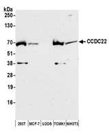 CCDC22 Antibody - Detection of human and mouse CCDC22 by western blot. Samples: Whole cell lysate (50 µg) from HEK293T, MCF-7, U2OS, mouse TCMK-1, and mouse NIH 3T3 cells prepared using NETN lysis buffer. Antibody: Affinity purified rabbit anti-CCDC22 antibody used for WB at 1:1000. Detection: Chemiluminescence with an exposure time of 30 seconds.