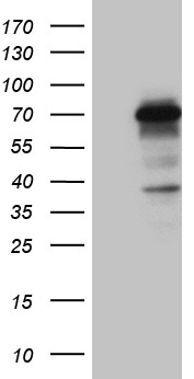 CCDC22 Antibody - HEK293T cells were transfected with the pCMV6-ENTRY control. (Left lane) or pCMV6-ENTRY CCDC22. (Right lane) cDNA for 48 hrs and lysed. Equivalent amounts of cell lysates. (5 ug per lane) were separated by SDS-PAGE and immunoblotted with anti-CCDC22. (1:2000)