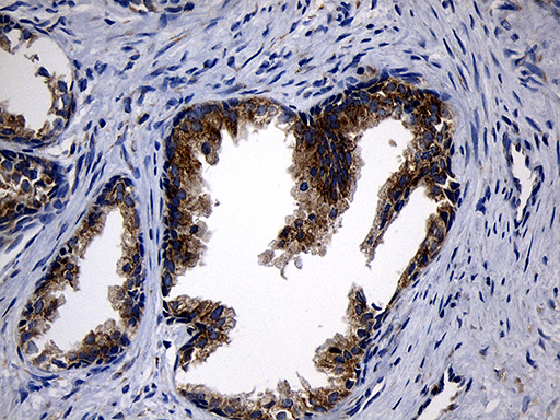 CCDC22 Antibody - Immunohistochemical staining of paraffin-embedded Human prostate tissue within the normal limits using anti-CCDC22 mouse monoclonal antibody. (Heat-induced epitope retrieval by 1mM EDTA in 10mM Tris buffer. (pH8.5) at 120°C for 3 min. (1:500)