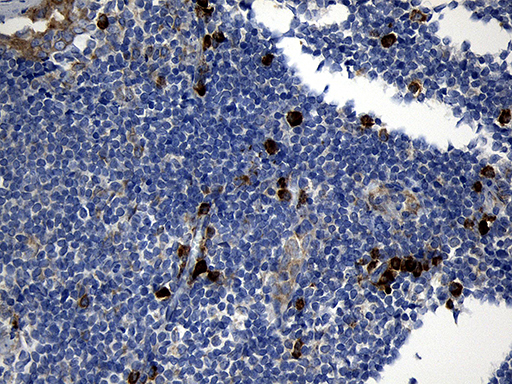 CCDC22 Antibody - Immunohistochemical staining of paraffin-embedded Human tonsil within the normal limits using anti-CCDC22 mouse monoclonal antibody. (Heat-induced epitope retrieval by 1mM EDTA in 10mM Tris buffer. (pH8.5) at 120°C for 3 min. (1:500)