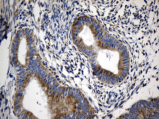 CCDC22 Antibody - Immunohistochemical staining of paraffin-embedded Human endometrium tissue within the normal limits using anti-CCDC22 mouse monoclonal antibody. (Heat-induced epitope retrieval by 1mM EDTA in 10mM Tris buffer. (pH8.5) at 120°C for 3 min. (1:500)