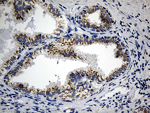 CCDC22 Antibody - Immunohistochemical staining of paraffin-embedded Human prostate tissue within the normal limits using anti-CCDC22 mouse monoclonal antibody. (Heat-induced epitope retrieval by 1mM EDTA in 10mM Tris buffer. (pH8.5) at 120°C for 3 min. (1:500)