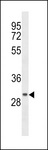 CCDC24 Antibody - CCDC24 Antibody western blot of MDA-MB453 cell line lysates (35 ug/lane). The CCDC24 Antibody detected the CCDC24 protein (arrow).