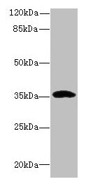 CCDC24 Antibody - Western blot All lanes: CCDC24 antibody at 6µg/ml + MCF-7 whole cell lysate Secondary Goat polyclonal to rabbit IgG at 1/10000 dilution Predicted band size: 35, 31 kDa Observed band size: 35 kDa